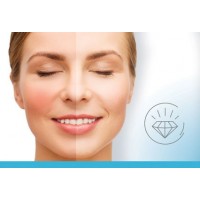 Tratamiento efectivo de la rosacea
